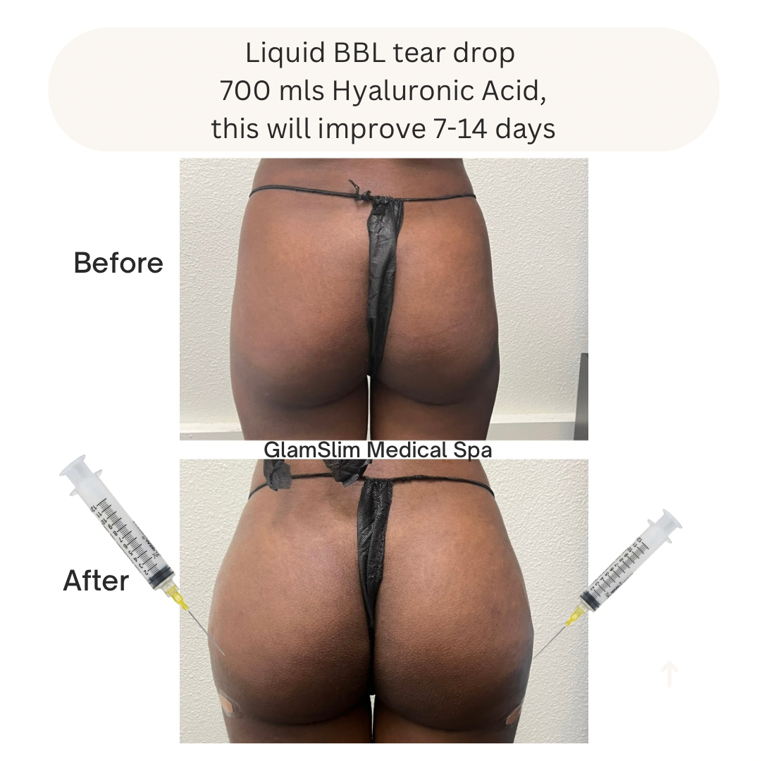 Liquid bbl Max Out