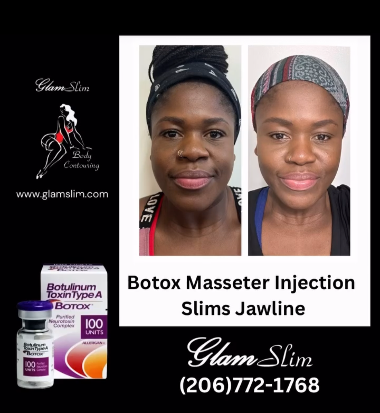 24 unit of Botox and 10mls Lemon Lipo Fat Dissolve